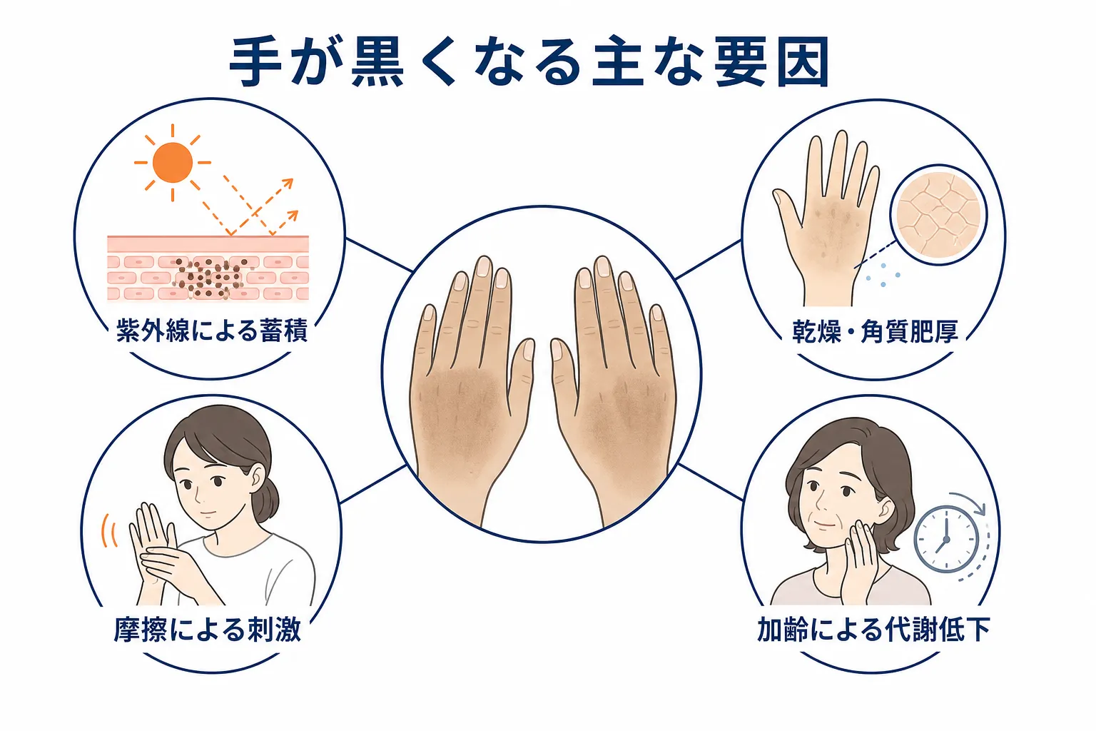 紫外線・乾燥・摩擦・加齢という4つの要因が重なり手の黒ずみにつながる様子を示す図
