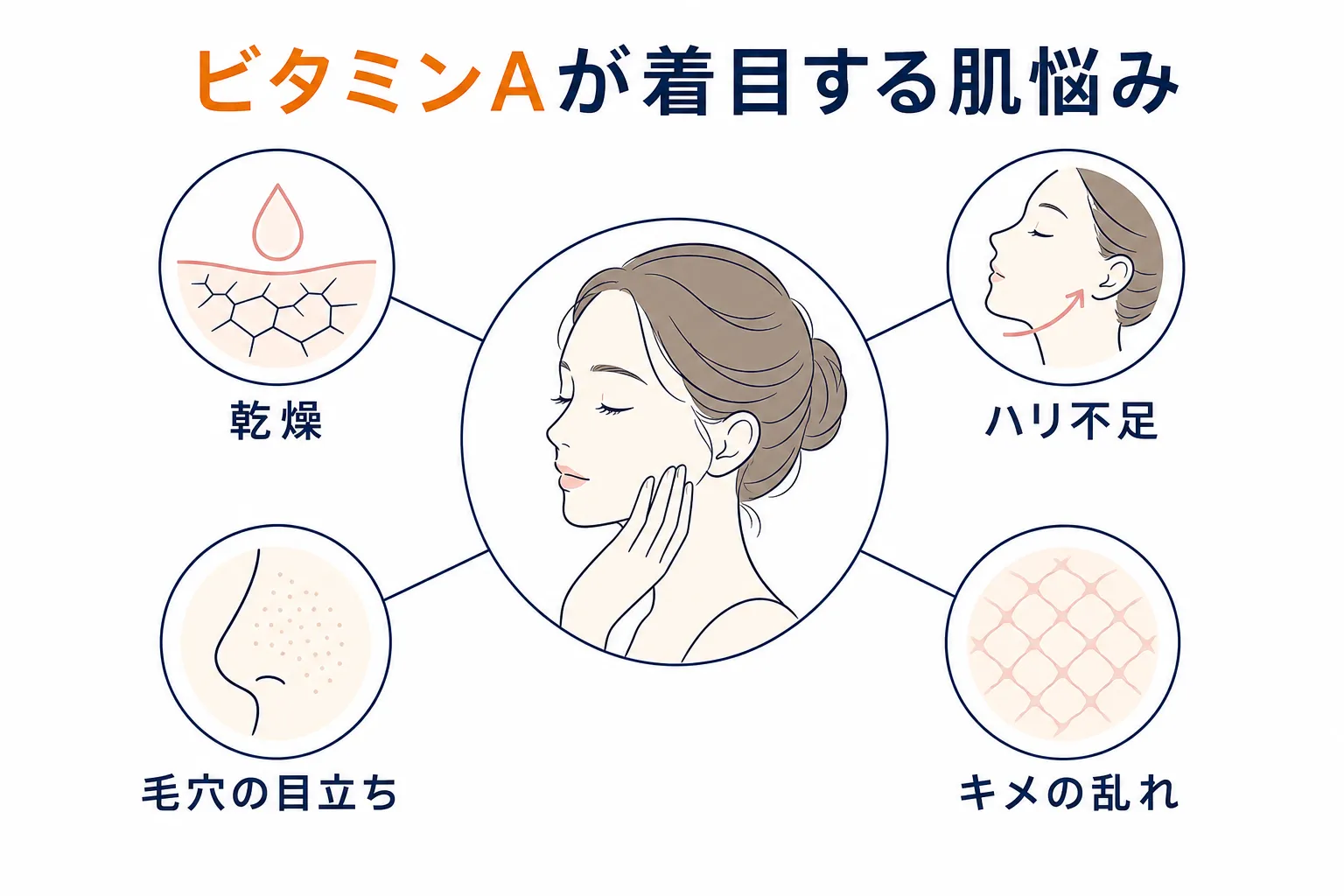 ビタミンAケアが着目する乾燥・ハリ不足・毛穴・キメの乱れを示す図